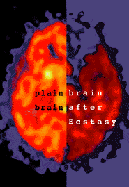 NIDA 'brain damage' ecstasy scare propaganda poster