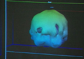 'holes' mdma ecstasy molly brain scan image from Oprah