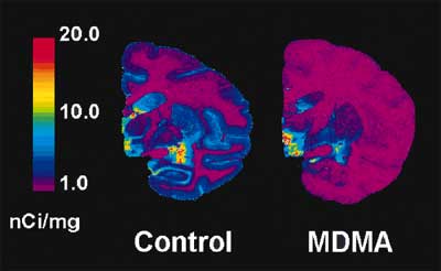 graphic of baboon brains SERT recovery after mdma neurotoxic damage